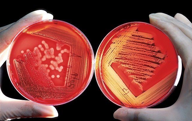 A person showing bacteria on two plates